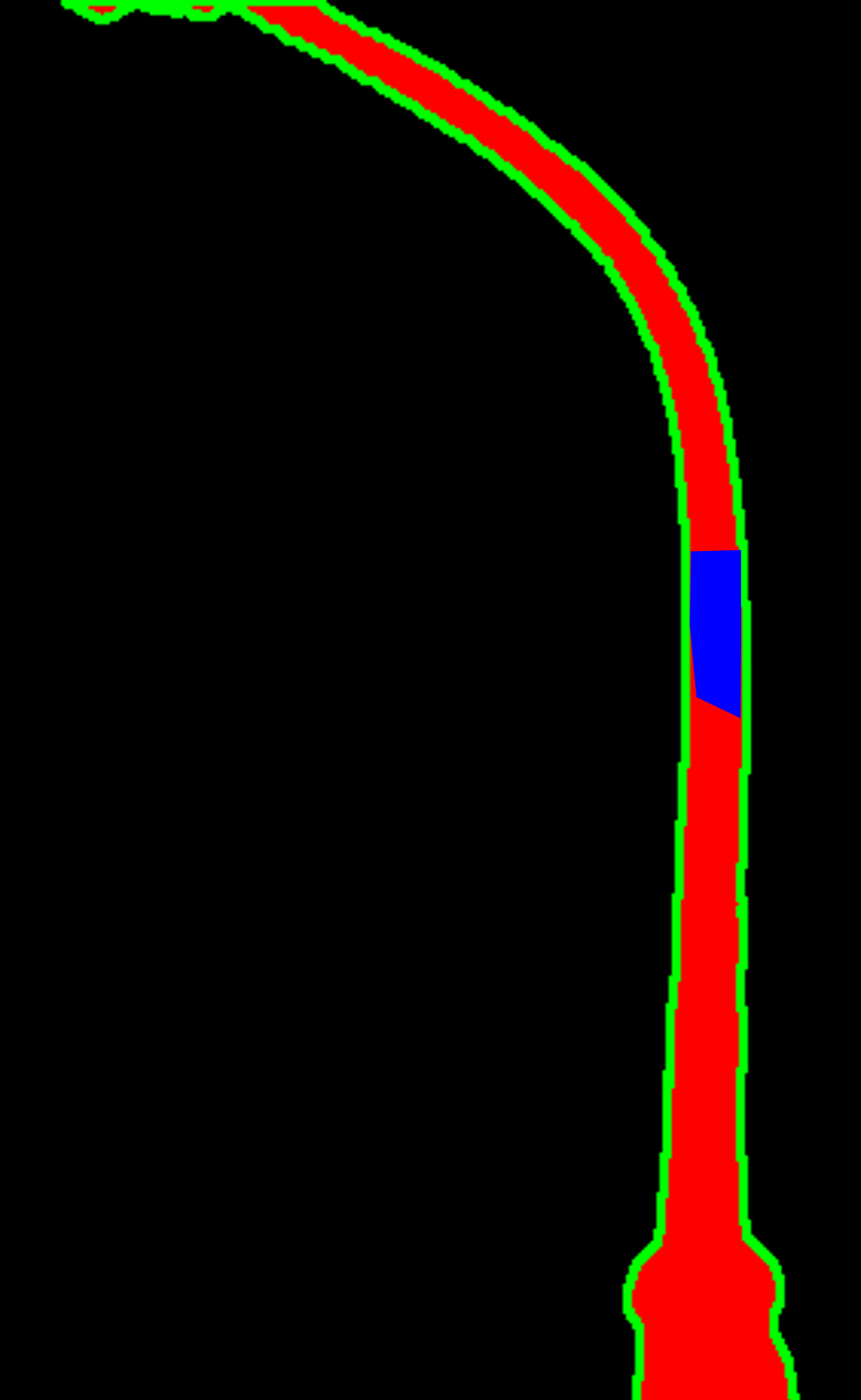 normal-and-abnormal-object-detection-dataset-by-lobster