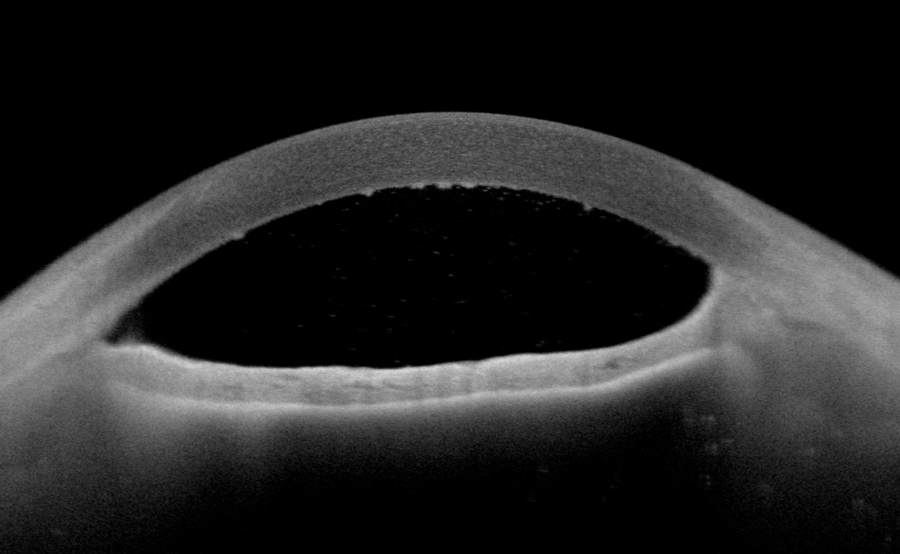 eye Object Detection Dataset by newworkspace9v21s