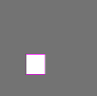 oral cancer types Object Detection Dataset and Pre-Trained Model by ...