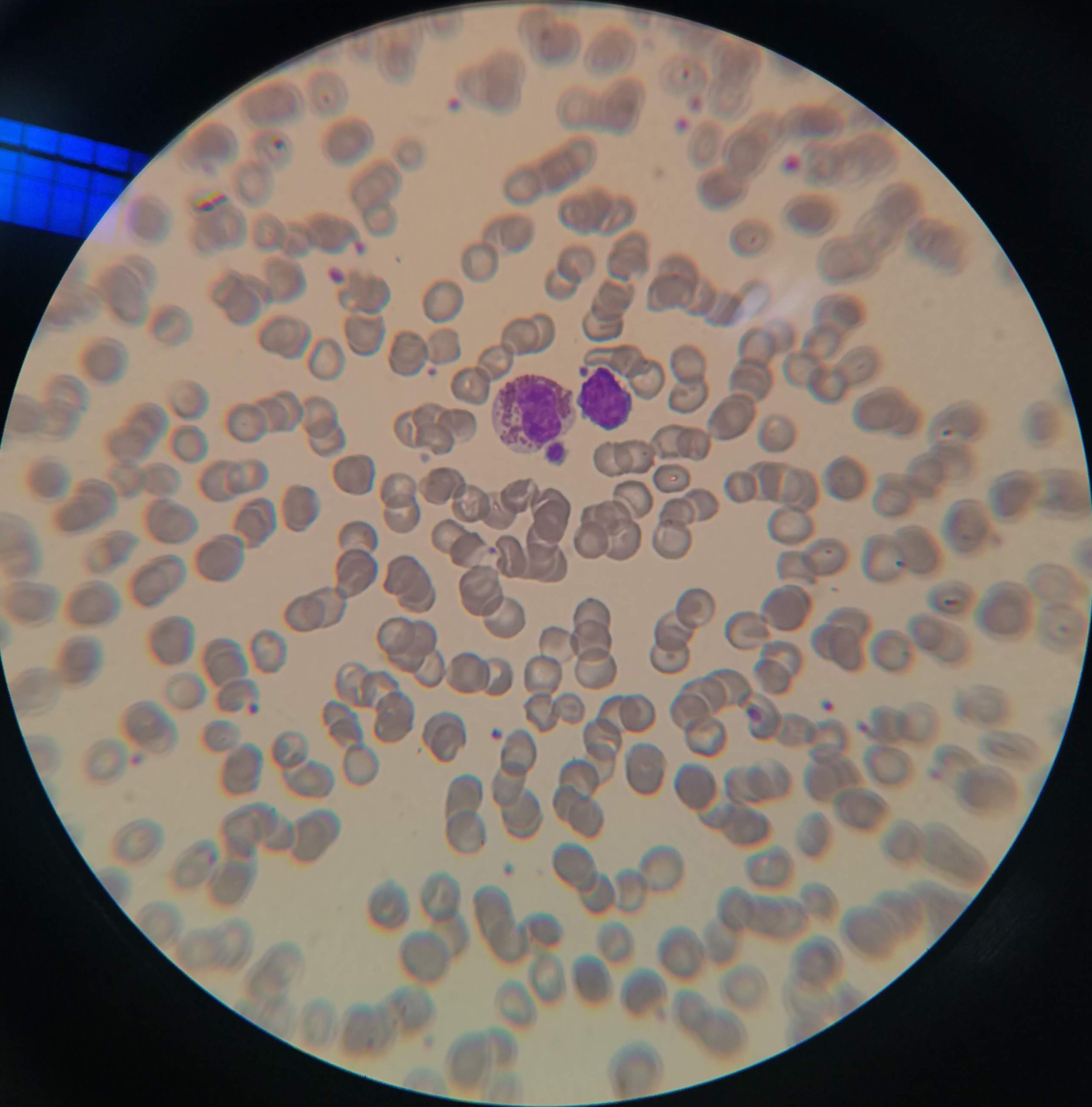 blood smear 2 Object Detection Dataset by Hiena