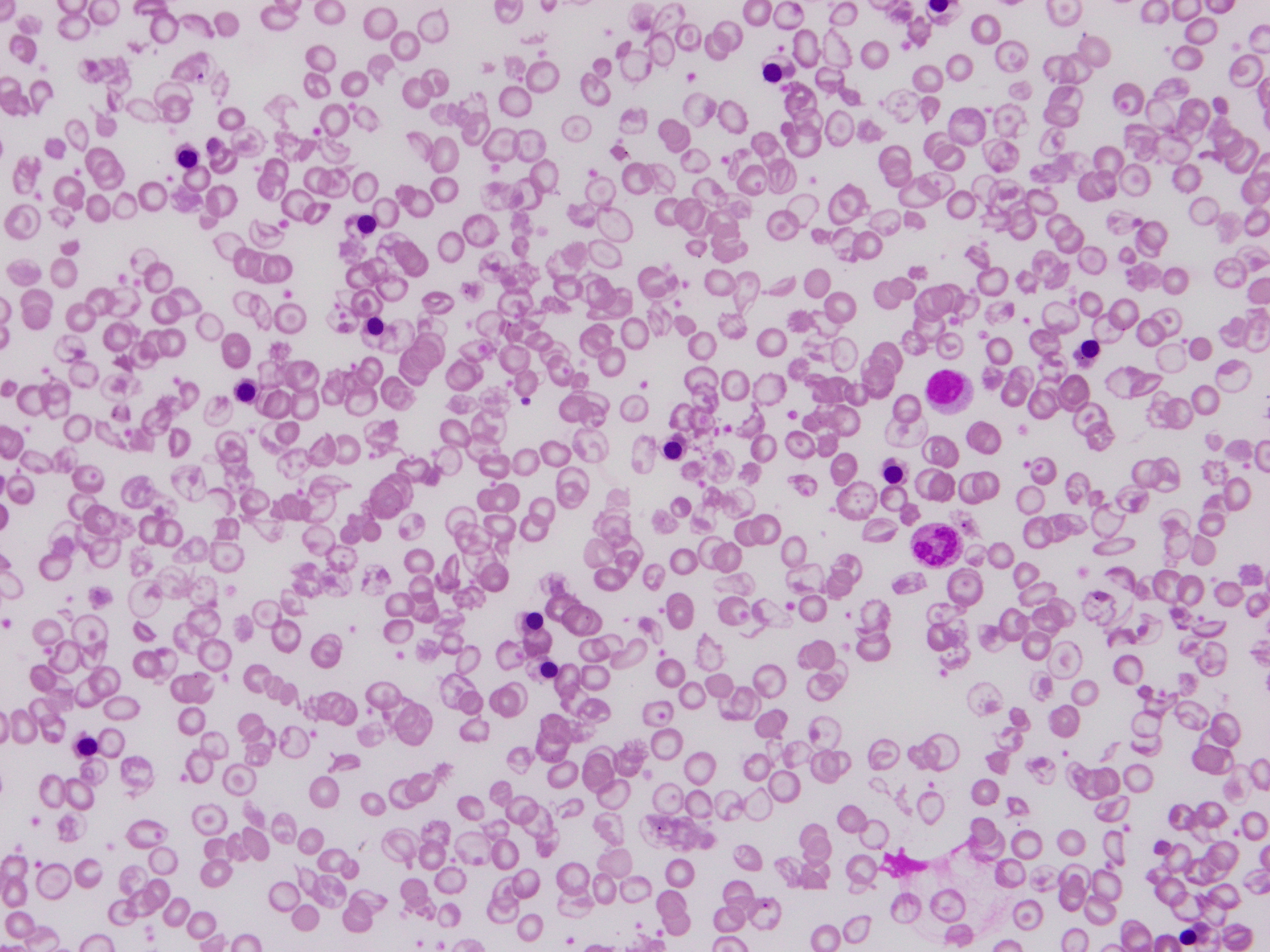 Detect Thalassemia Classification Dataset and Pre-Trained Model by AI