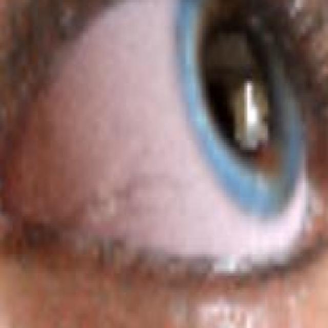 Eye Health Object Detection Dataset and PreTrained Model by cdacm