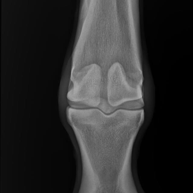 equine xray 2 classes Object Detection Dataset by capstone