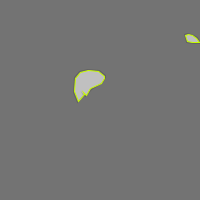 Annotation Visualization