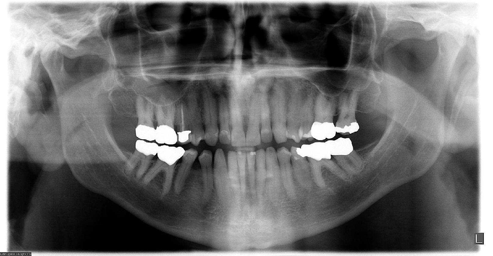 Dental classification dataset and pre trained model by musah abdulazeez