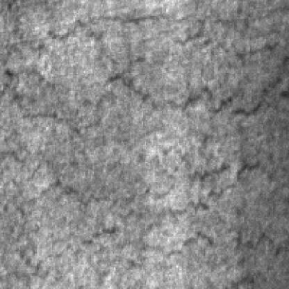 NEU-DET Object Detection Dataset by DefectDatasets