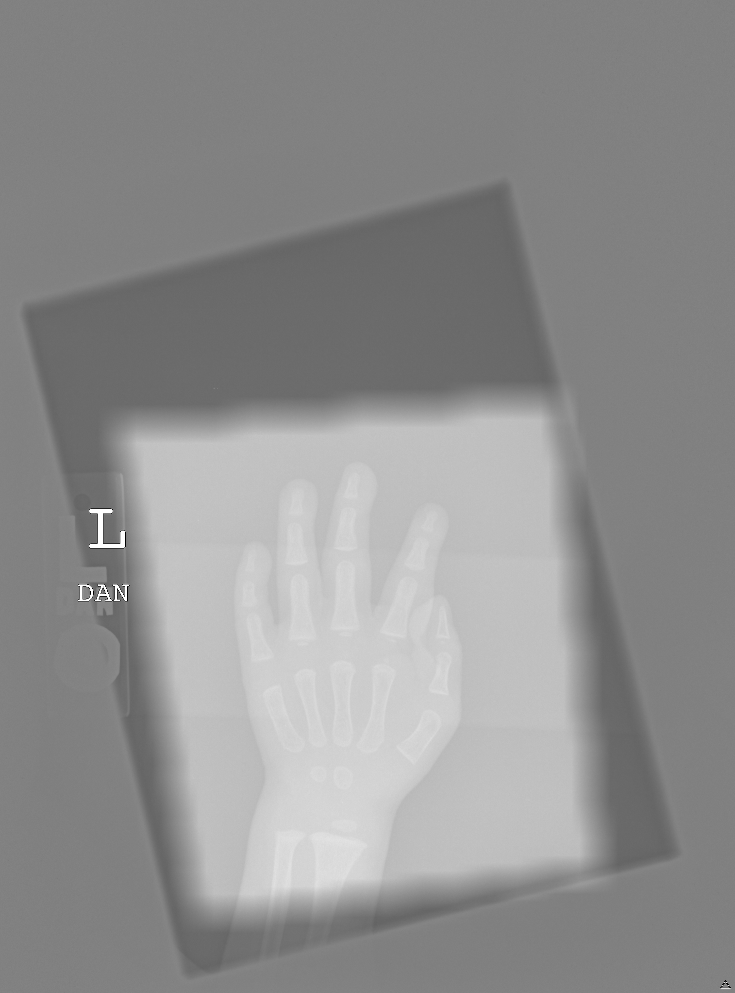 Finger Wrist Detection Object Detection Dataset and Pre-Trained Model ...