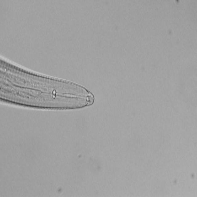 Nematodes Object Detection Dataset and PreTrained Model by Parasites