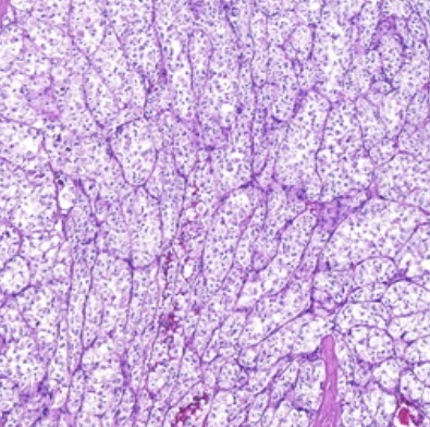 Soft Tissue Histopathology Classification Classification Dataset and Biology Diagrams