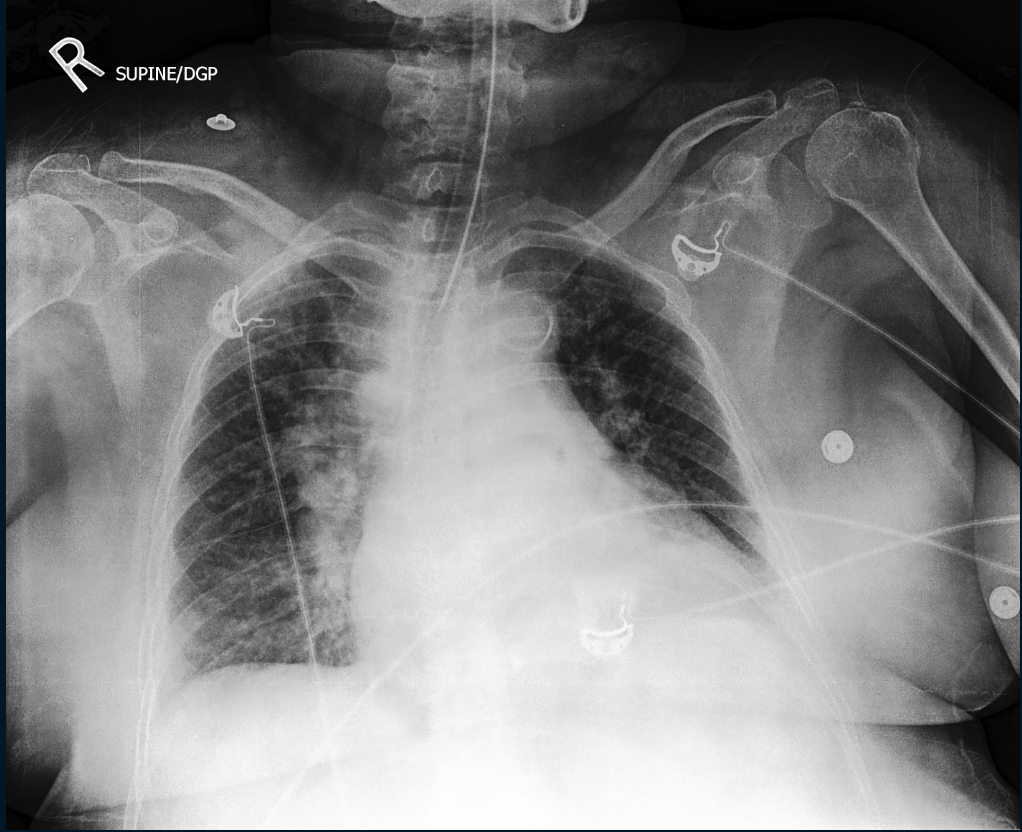 Chest Test Classification Dataset by Mila Hong