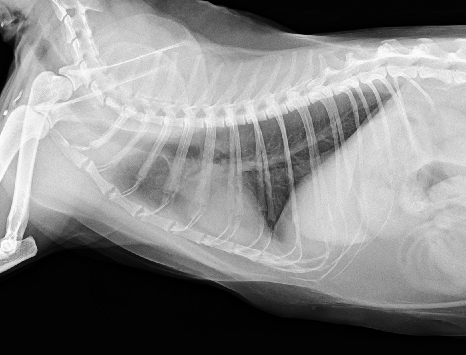 chest xray (chest-xray-mabco) - Roboflow Universe