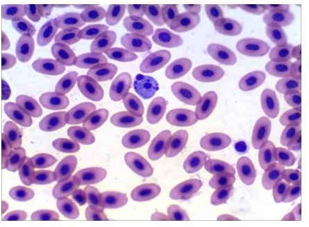 blood cells Object Detection Dataset and Pre-Trained Model by Work Project