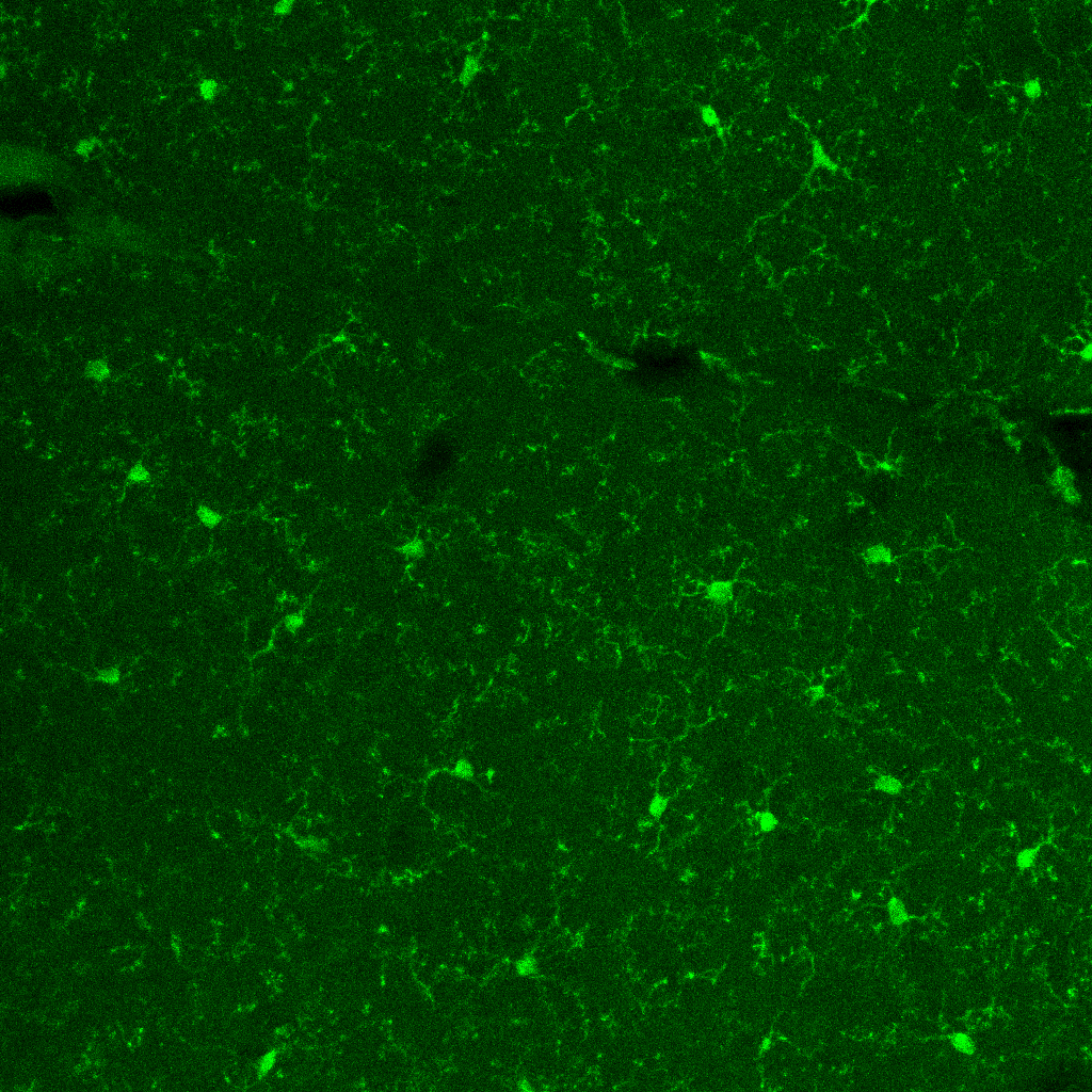 segmentation-practice-roboflow-universe