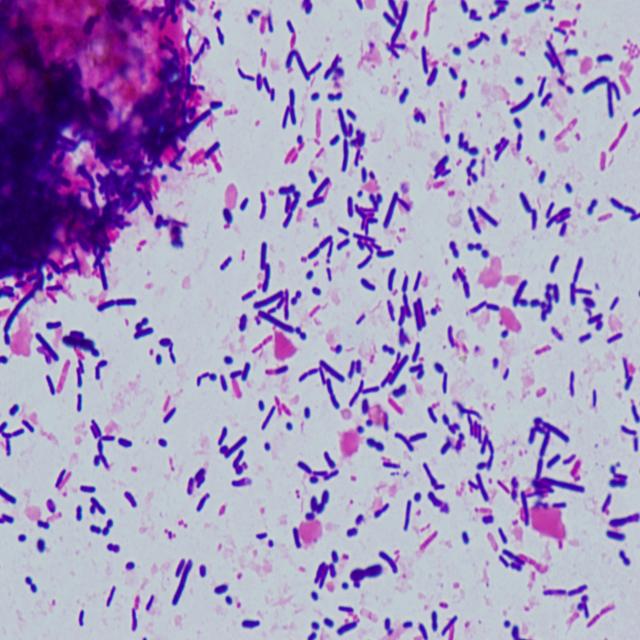 Campylobacter_3 Object Detection Dataset and Pre-Trained Model by ...