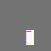 X ray bone fracture Object Detection Dataset and Pre-Trained Model by Unit