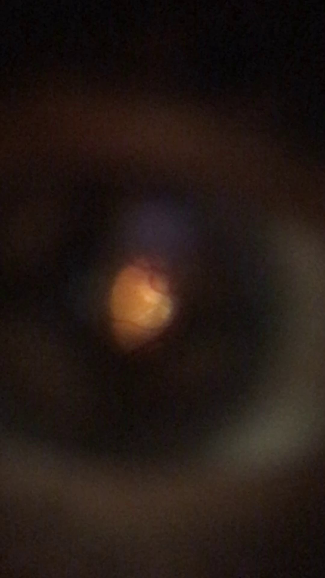 Retina Segmentation Object Detection Dataset by UFMA