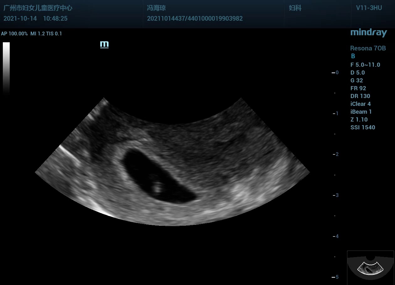 fetal-heart-5w-object-detection-dataset-by-yuanyuanpei7