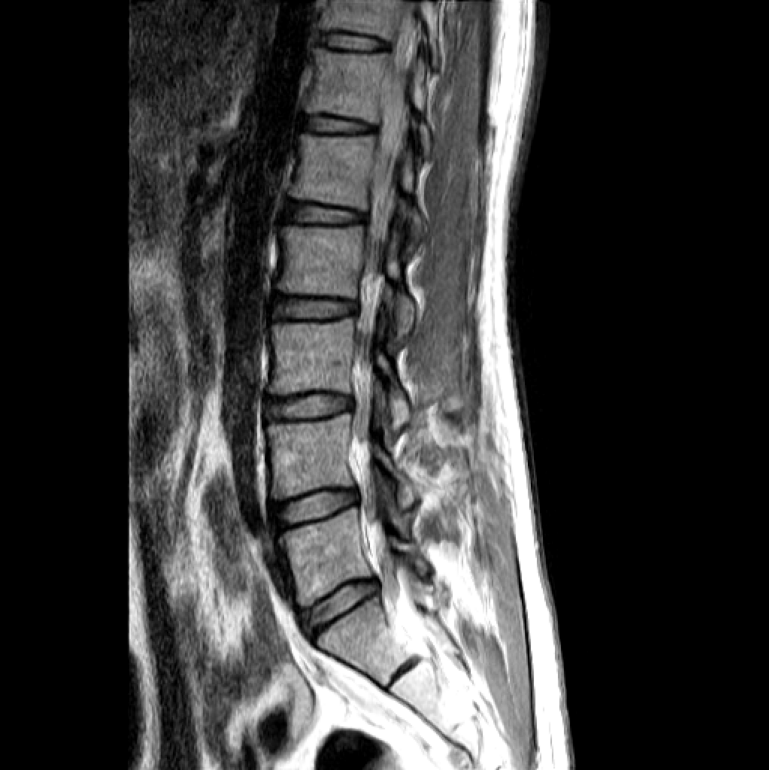 How to Use the segmentation of spine MRI Semantic Segmentation API