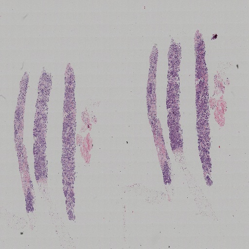 BCNB - Roboflow Universe