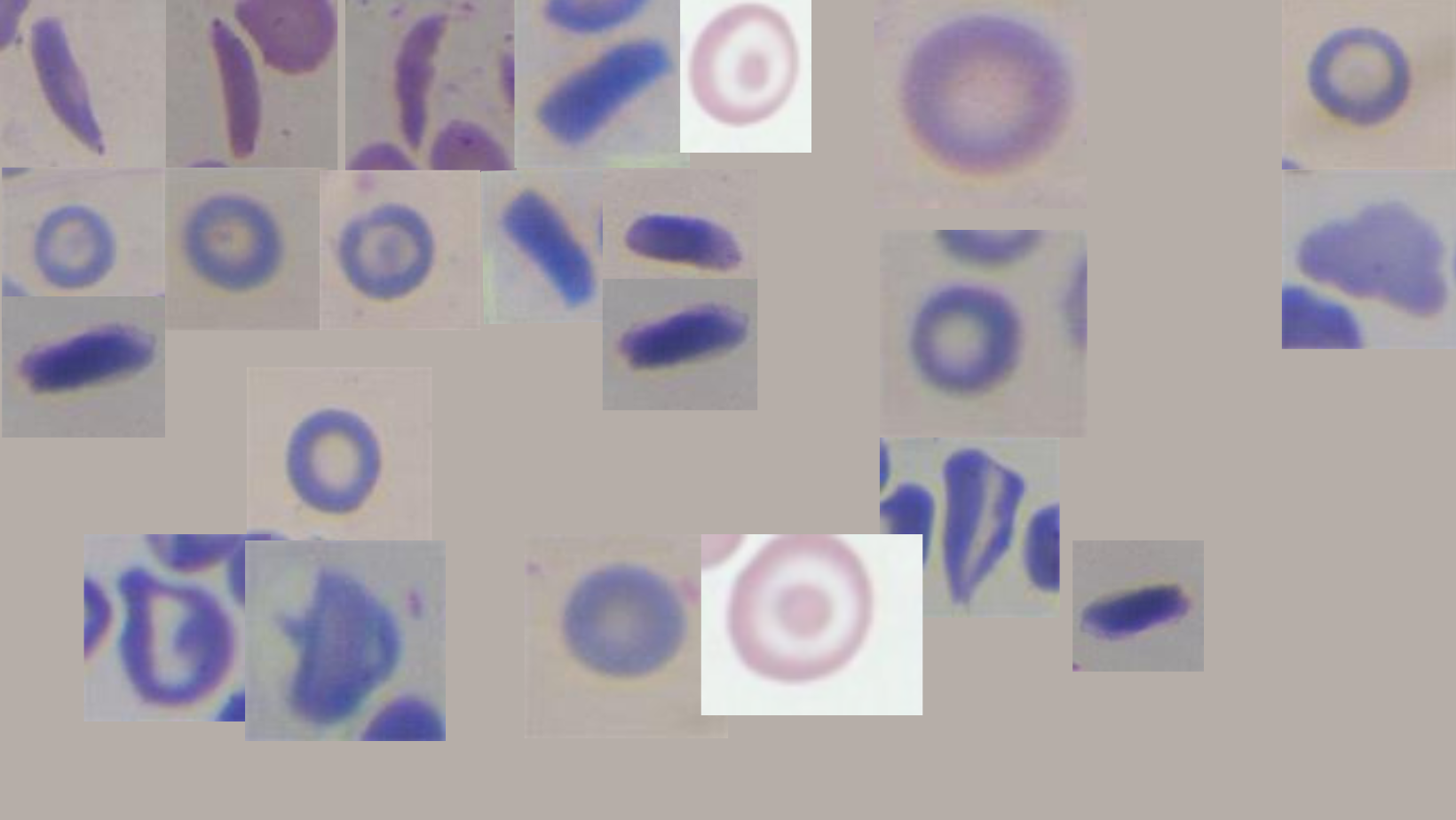 Synthetic_RBC2 Object Detection Dataset by Roufa