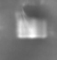 Pin_G7_train Object Detection Dataset by Needle implantation