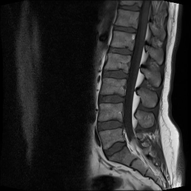 Lumbar-spine Semantic Segmentation Dataset By Faro