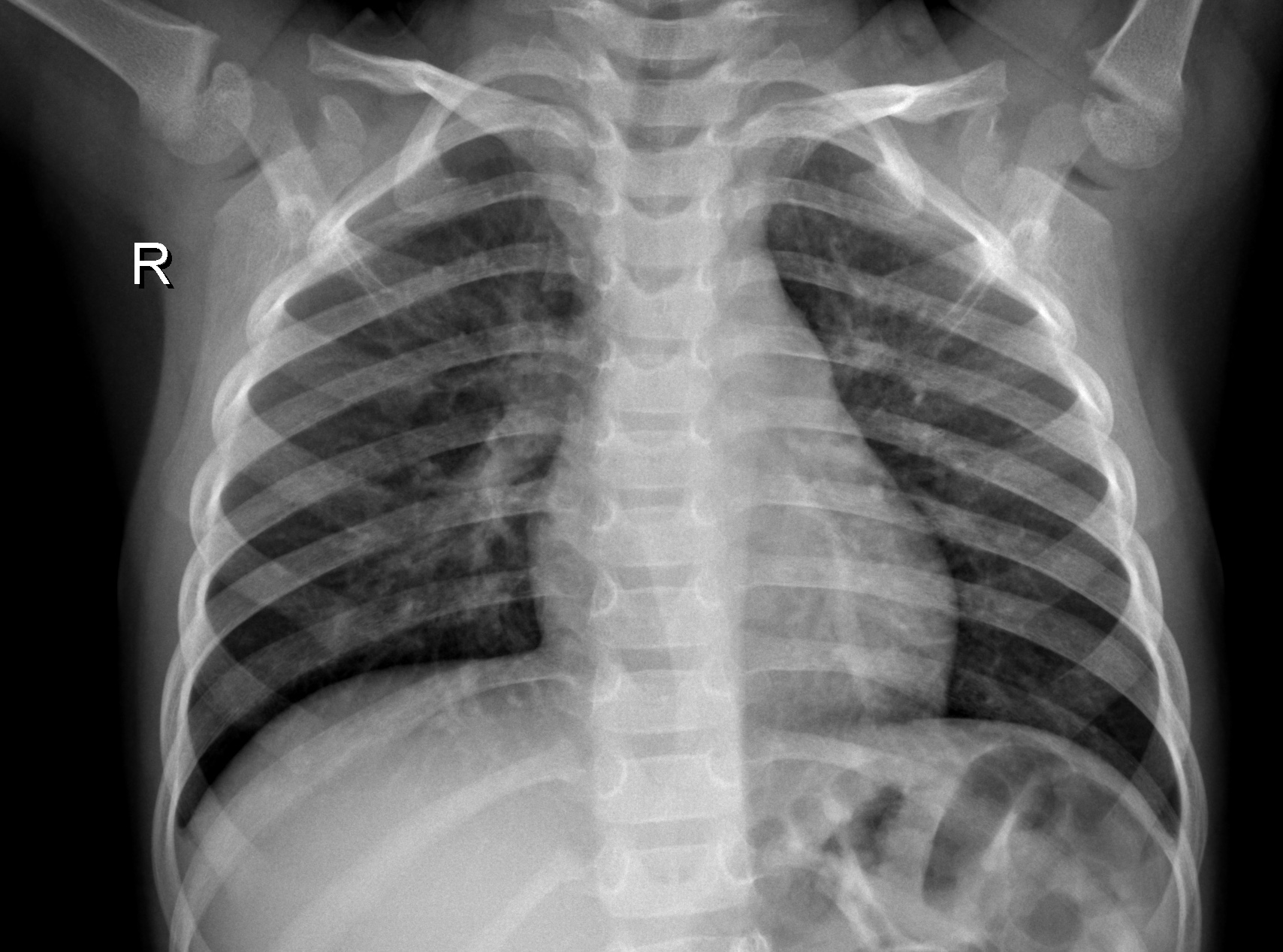 x-rays Object Detection Dataset by tao