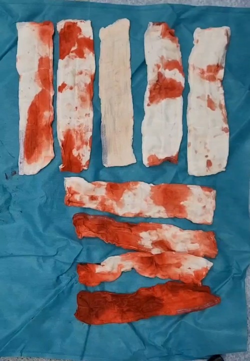 new gause Object Detection Dataset by detect1