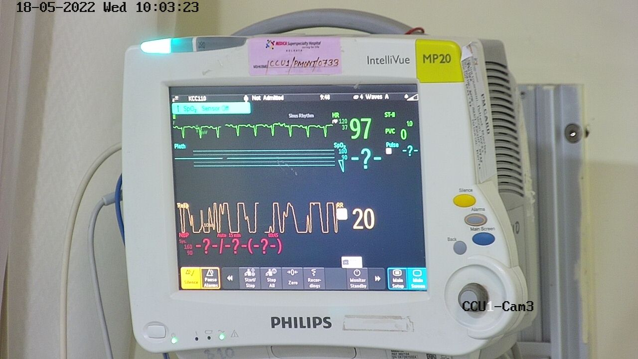 ICU Monitors Instance Segmentation Dataset by KingAJ