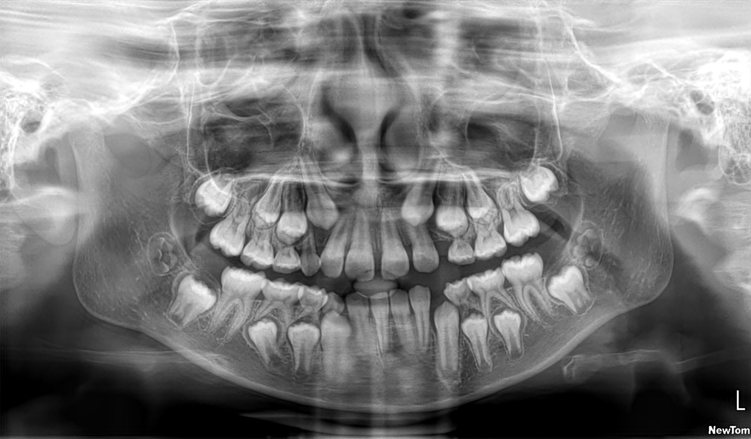 Dental AI Object Detection Dataset by Dental AI