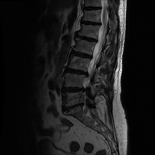 lumbar Object Detection Dataset by lab