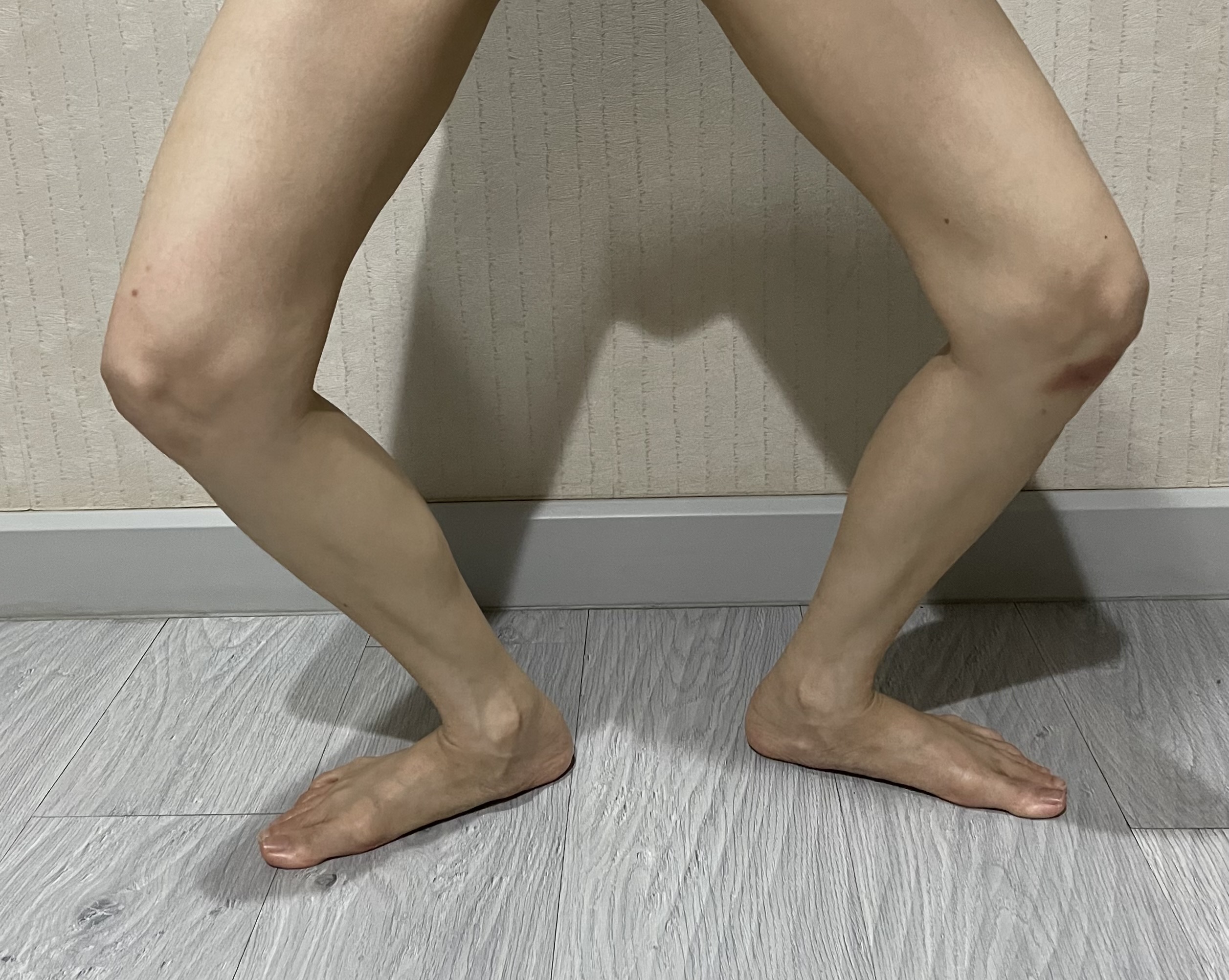 Jump landing (jumplandingaovjh) Roboflow Universe