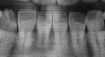 With-Cavity Classification Dataset by BioMET