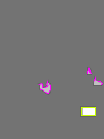 Annotation Visualization